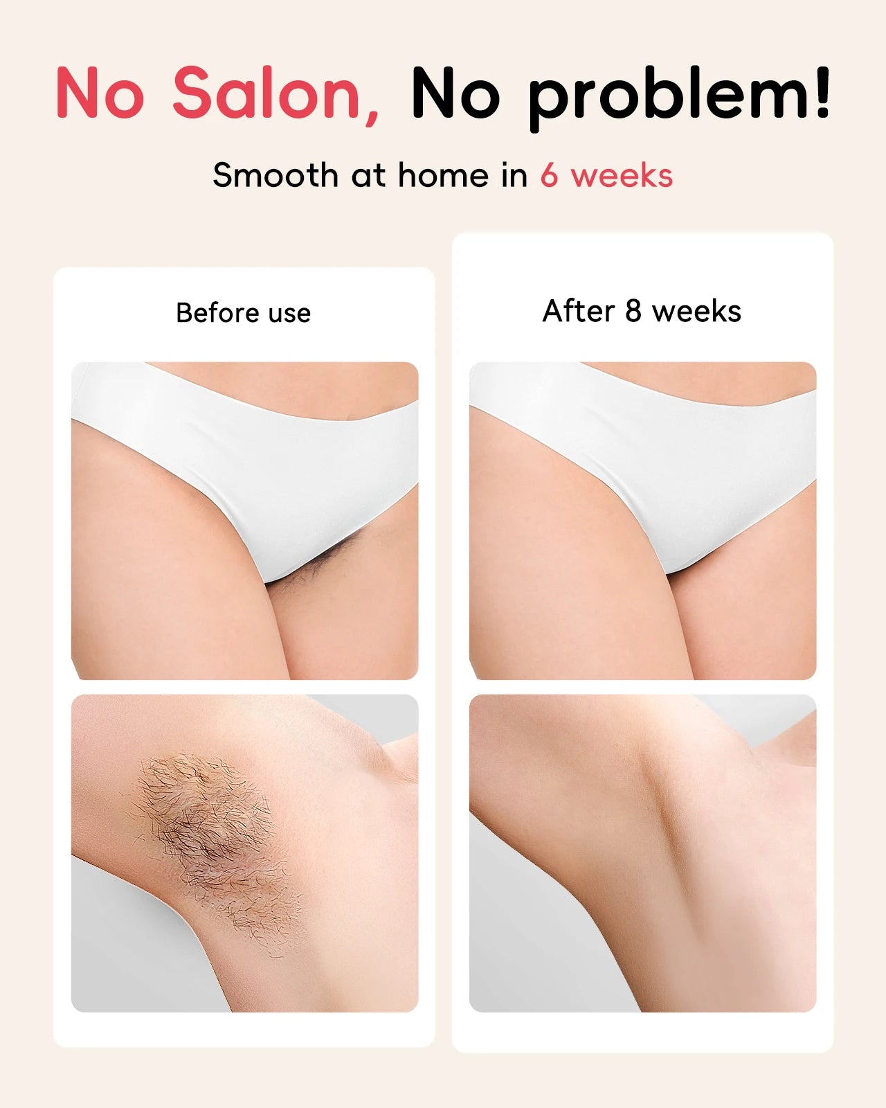 Laser Hair Removal IPL 22J Painless Ultra-Fast for Men & Women
